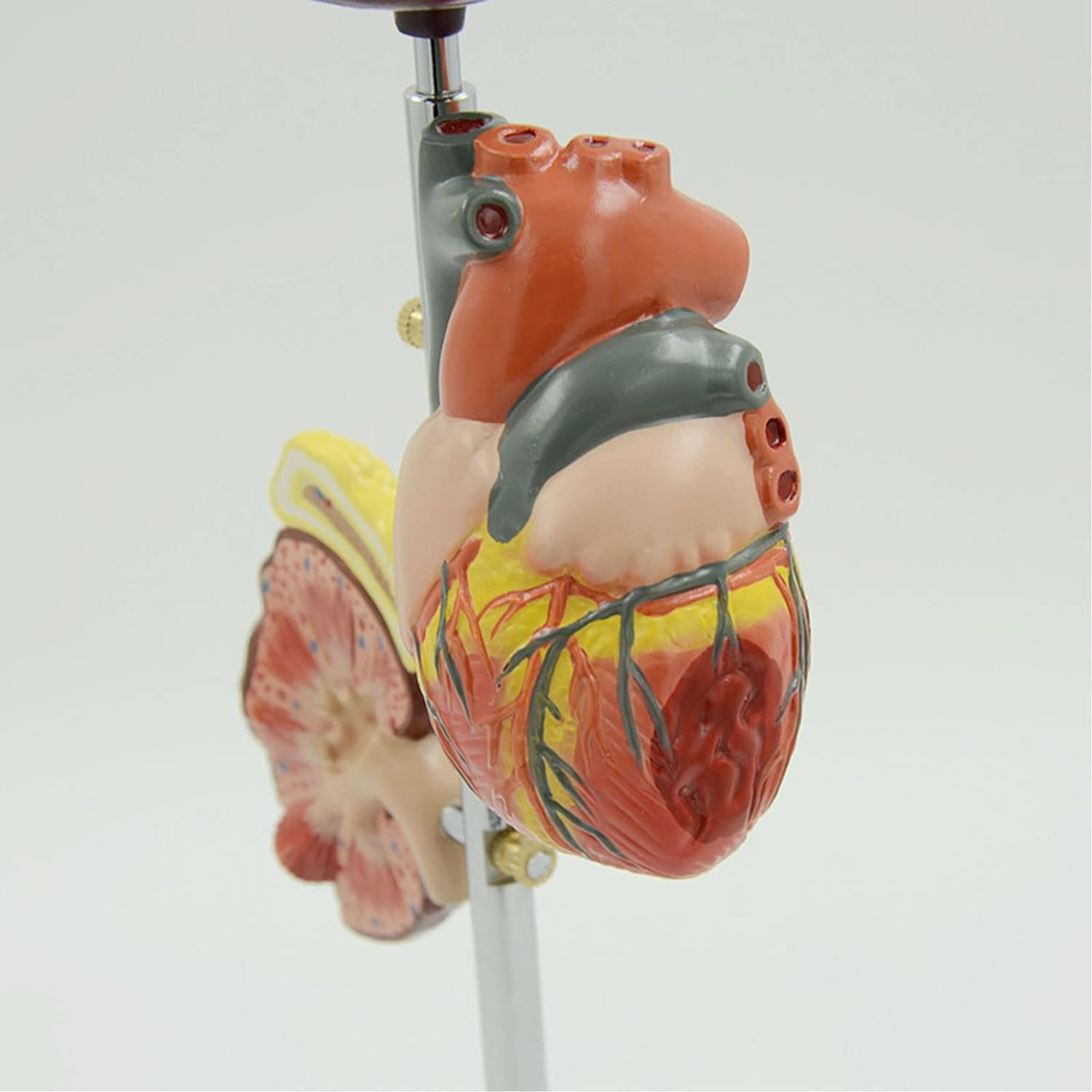 Human Organ Dissection Model Diabetes Pathology Demonstration Anatomy Model Pathological Model Human Diabetic Organ Model Diabetes Complications Display Model Pathological Diabetes Anatomy Model