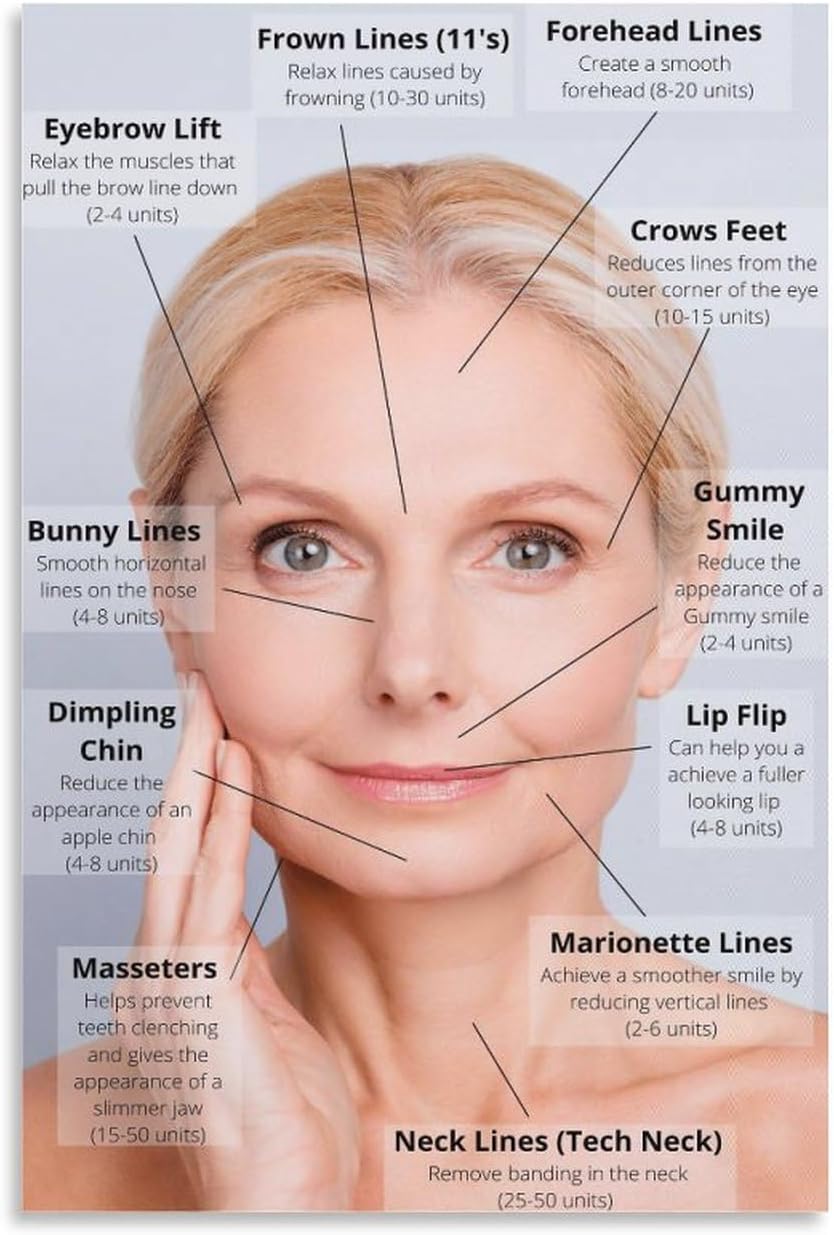 HEZLA Beauty Salon Poster Face Botox Injections Poster Canvas Painting Posters And Prints Wall Art Pictures for Living Room Bedroom Decor 12x18inch(30x45cm) Unframe-style