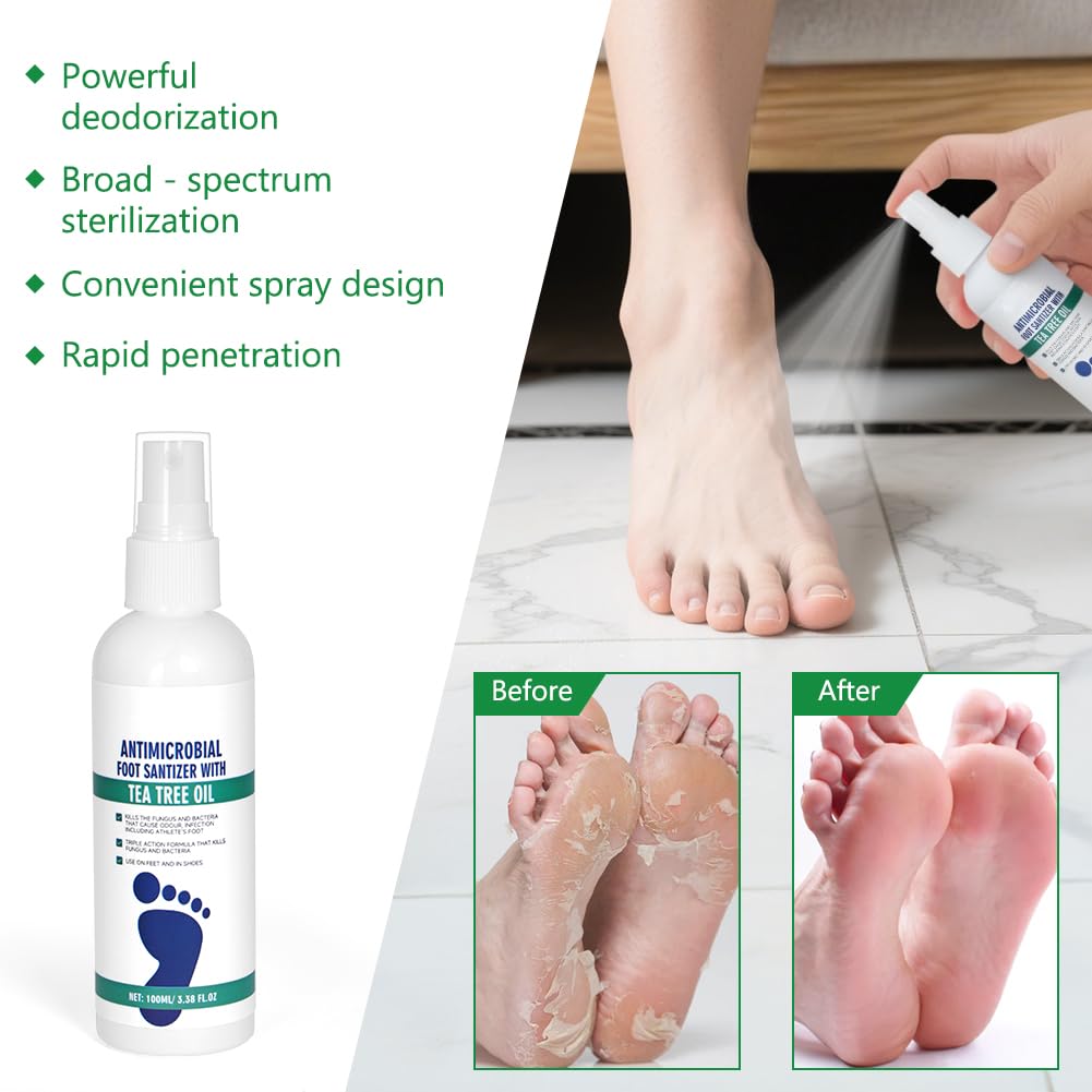 AOOWU Spray Purificante de Pies para hombres y mujeres, para Micosis, Controla el Olor, Spray Fungicida Antiséptico