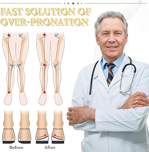 Miniatura 4 de BIGGCOOL Plantillas correctivas para supinación y sobrepronación, plantillas ortopédicas de cuña de talón medial y lateral para alineación de pies,