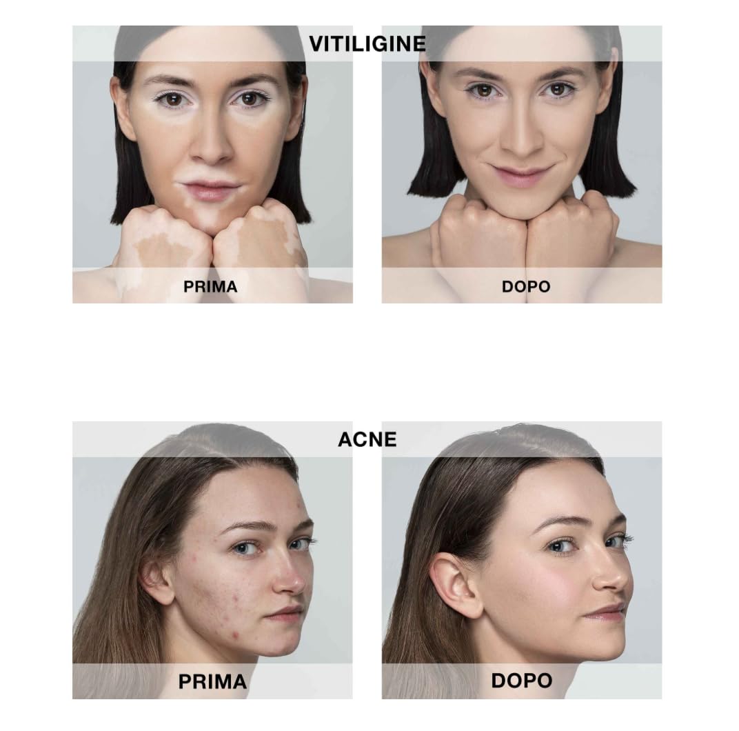 Bionike Defence Cover - Fondotinta Correttore Fluido Alta Coprenza SPF 30, per Pelli Sensibili e Intolleranti con Discromie, Contrasta gli Inestetismi della Pelle, Effetto Comfort a Lunga Durata 40 ml