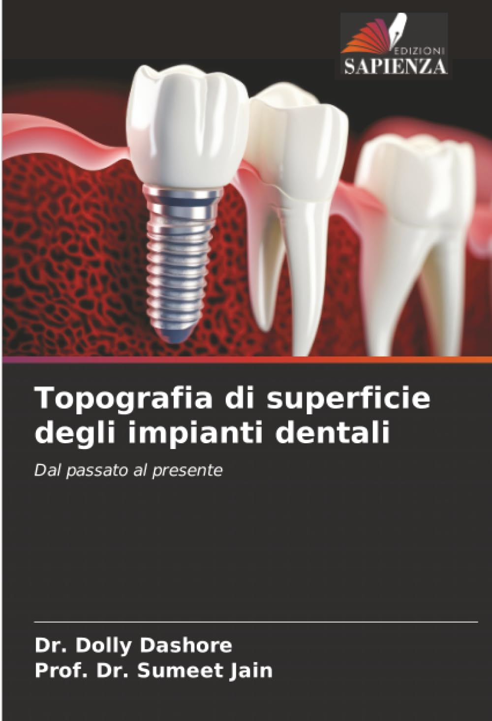 Topografia di superficie degli impianti dentali: Dal passato al presente