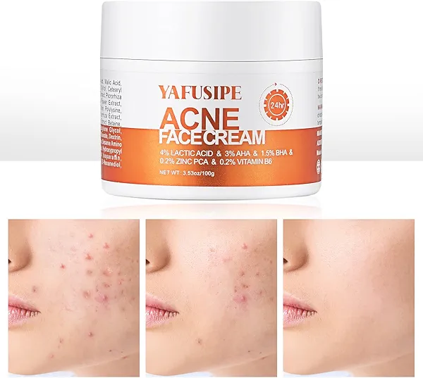 Acne Treatment for Face for Hormonal Cystic Stubborn Acne Cream for Sensitive Skin Teens Adults Women Men Spot Pimple Butt Control Rapid Clearing Breakout Overnight Face Blemish Treatment Moisturizer
