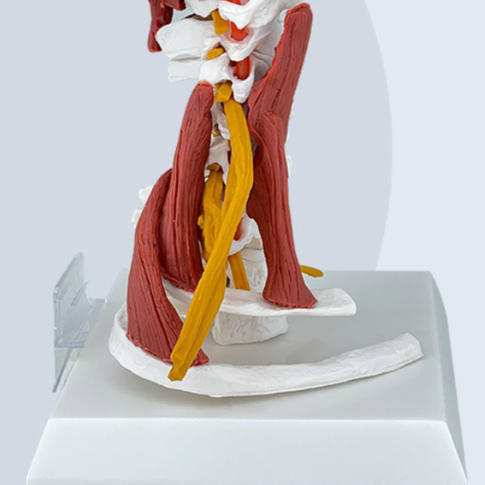 Modello di Vertebra Cervicale con Nervi e Muscoli Smontabile Modello Della Colonna Cervicale Umana Alta Precisione per Studio Medico