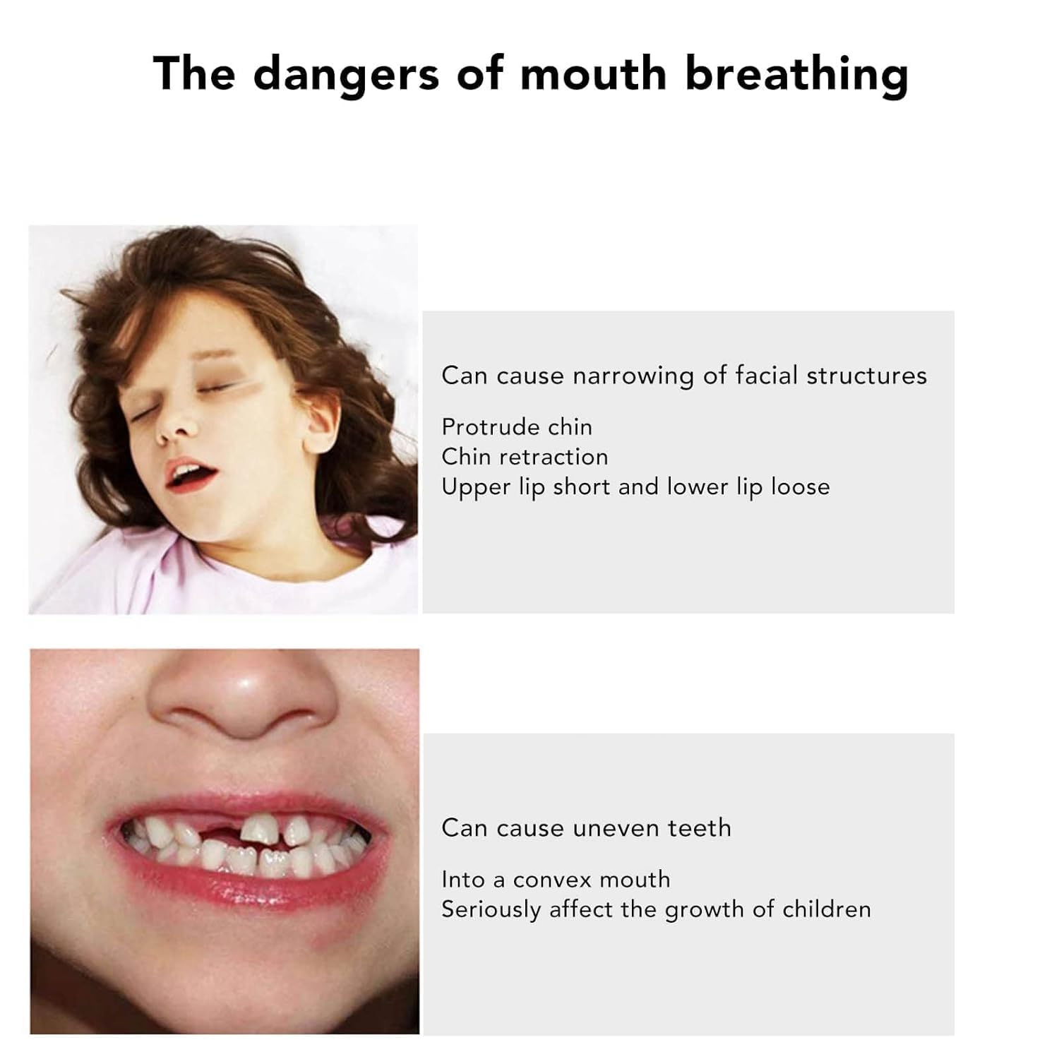iYOGIzz Kids Sleep Strips (30 Pcs) Mouth Tape Anti-Suffocation Design Mouth Shape Gentle Adhesive Stretchable Sleep Aid for Nose Breathing Snoring Relief Safe Comfortable Night Sleep for Children 1