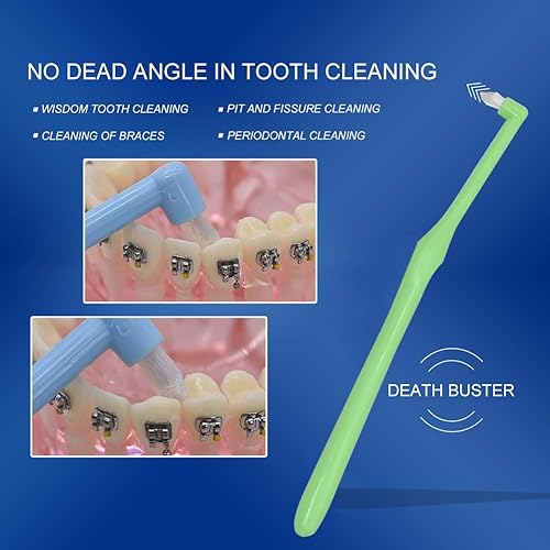 Miniatura 6 de Angzhili Juego de 9 cepillos de dientes interespaciales, cepillos de ortodoncia cónicos para áreas difíciles de alcanzar, cepillo de dientes para