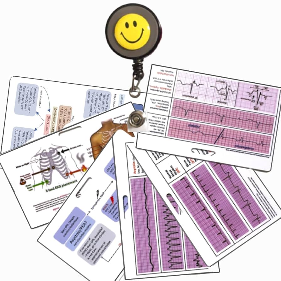 Amazon.com : 6 EKG Badge Cards, Cardiac Badge Reference + (EKG Cheat Sheets PDF) - Tele, ICU, ER Nurse Card, Nursing Student, EMT, EMS, Paramedics, Nursing School : Office Products amazon-com-6-ekg-badge-cards-cardiac-badge-reference-ekg-cheat-sheets-pdf-tele-icu-er-nurse-card-nursing-student-emt-ems-paramedics-nursing-school-office-products