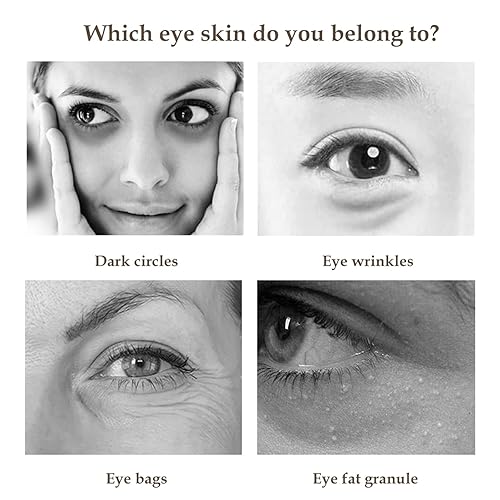 Miniatura 10 de HMDABD Bells Parálisis Eye Patch Peptide Eye Care Reduce Bolsas Ojos Ojos Círculos Oscuros Hidrata Ilumina Reparaciones Y Tensa La Piel Alrededor De