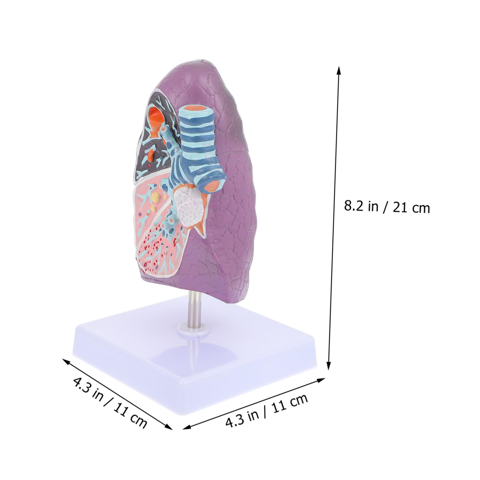 Modèle Pulmonaire D'anatomie Pathologique pour Enseignement Médical