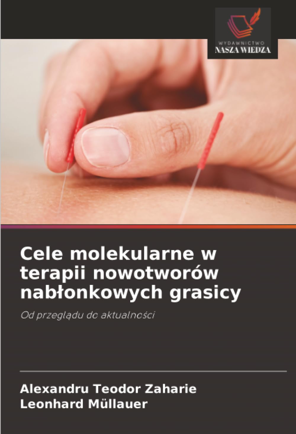 Cele molekularne w terapii nowotworów nabłonkowych grasicy: Od przeglądu do aktualności: Od przegl¿du do aktualno¿ci