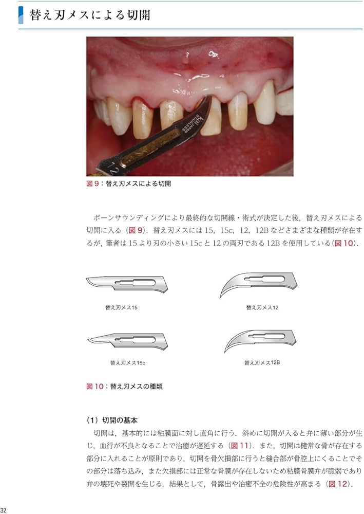 ゼロから見直す歯周外科治療 ゼロから見直す歯周外科治療 | 松延 允資 |本 | 通販 | Amazon