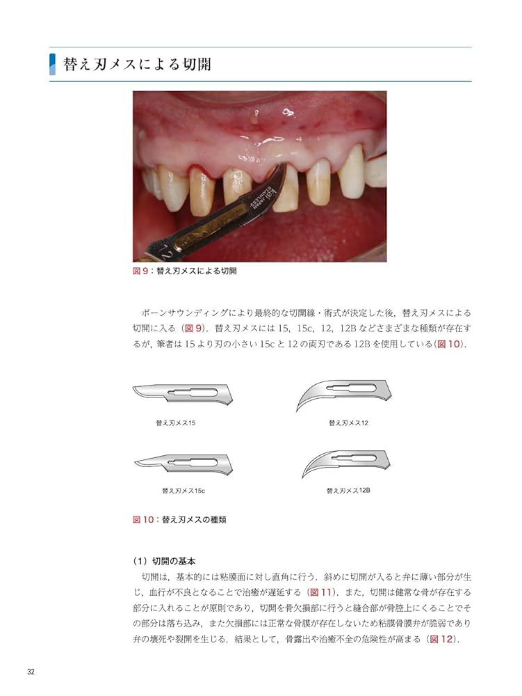 ゼロから見直す歯周外科治療 ゼロから見直す歯周外科治療 | 松延 允資 |本 | 通販 | Amazon