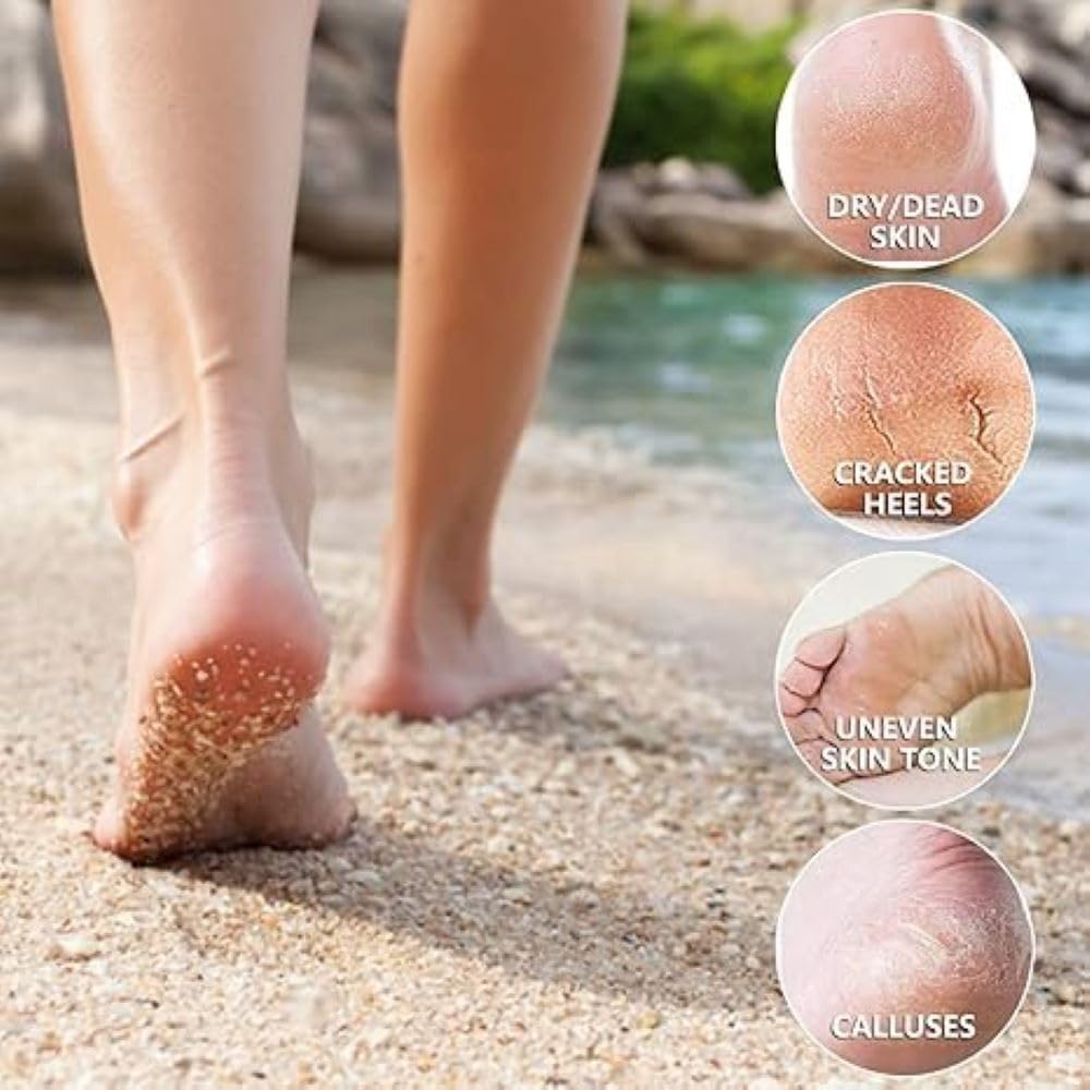 Krupasadhya Foot Peeling Mask For Dead Skin Removal, Peeling & Exfoliating Foot Mask for Dry Cracked Feet, Removes Dead Skin & Calluses, Men And Women Feet Peeling Mask Exfoliating. (Lavender) 2