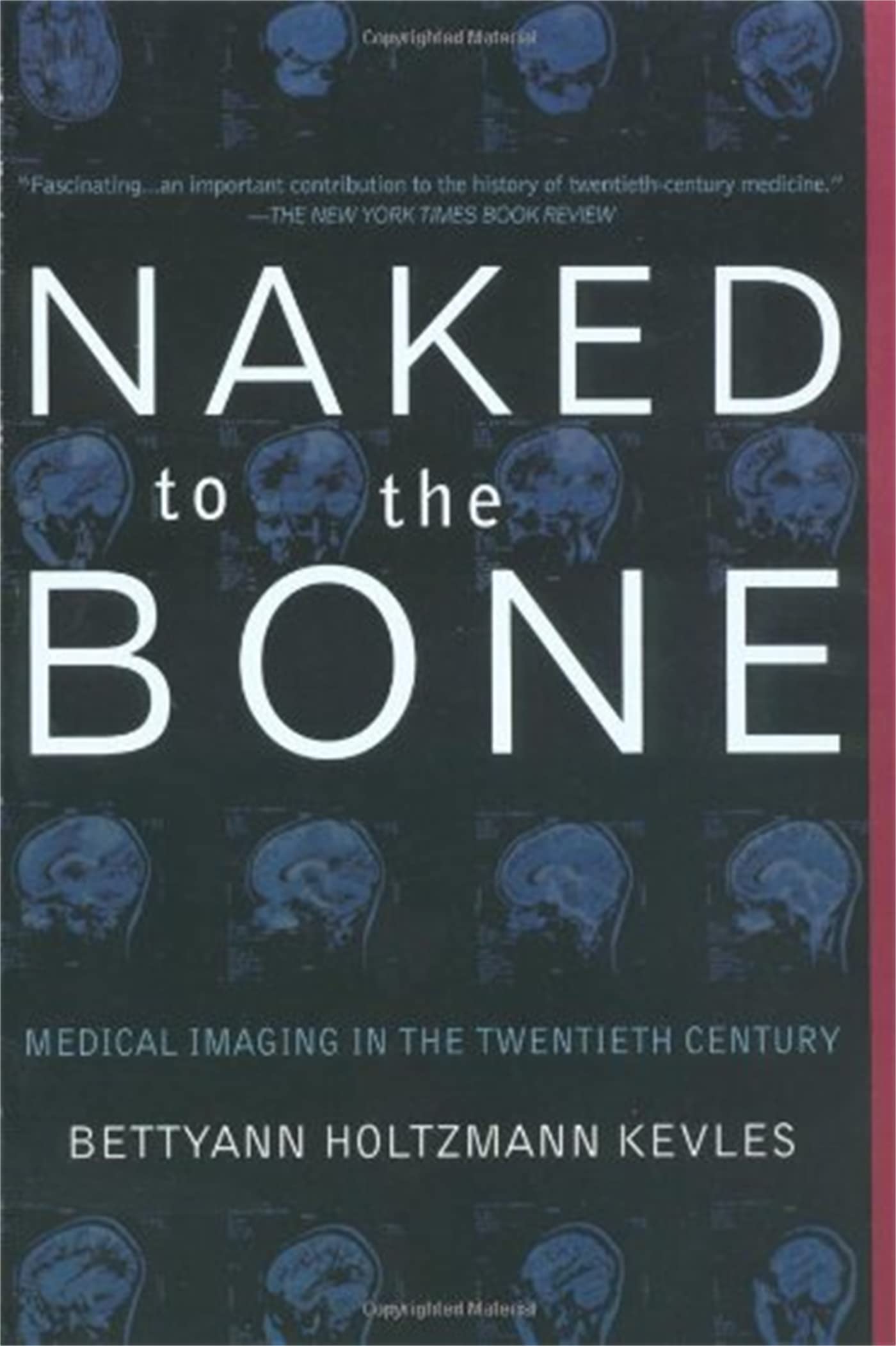 Naked to the Bone: Medical Imaging In The Twentieth Century
