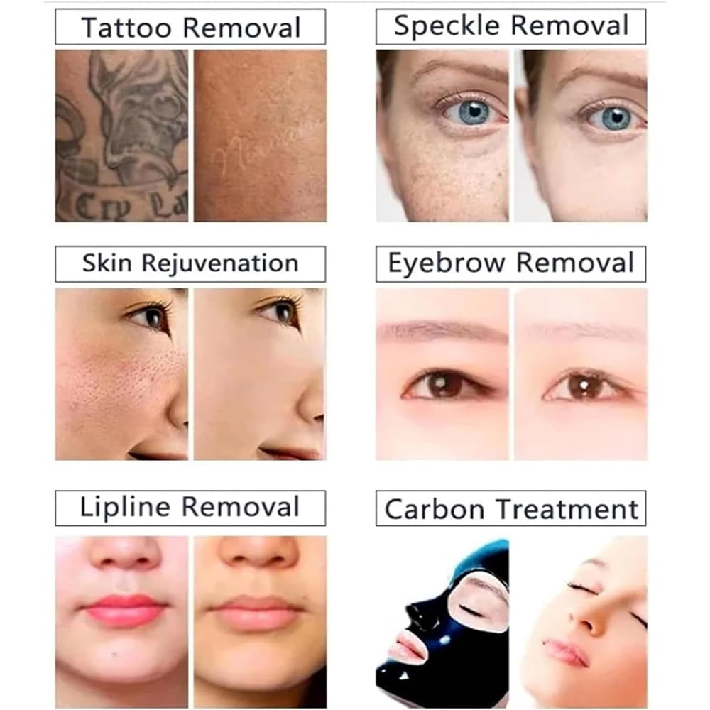 Profesjonalne urządzenie do laserowego usuwania tatuaży, laser pikosekundowy do usuwania pigmentu do brwi, piegów, pieprzyków i ciemnych plam, z tarczą celowniczą i systemem chłodzenia