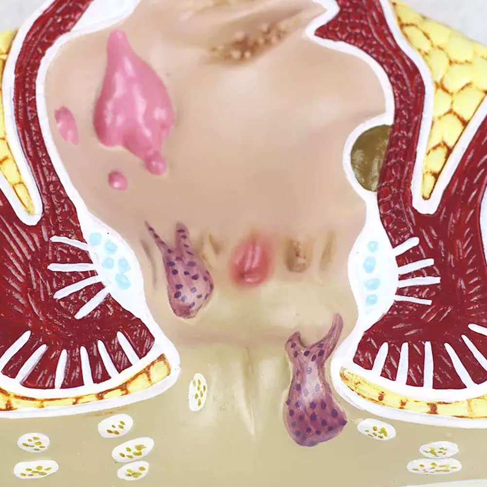 Model Odbytnicy Człowieka Odbytnicy Model Powiększenia Zmian Patologicznych Model Rozszerzenia Układu Trawienia Anatomia-Modele Medyczne Materiały Edukacyjne