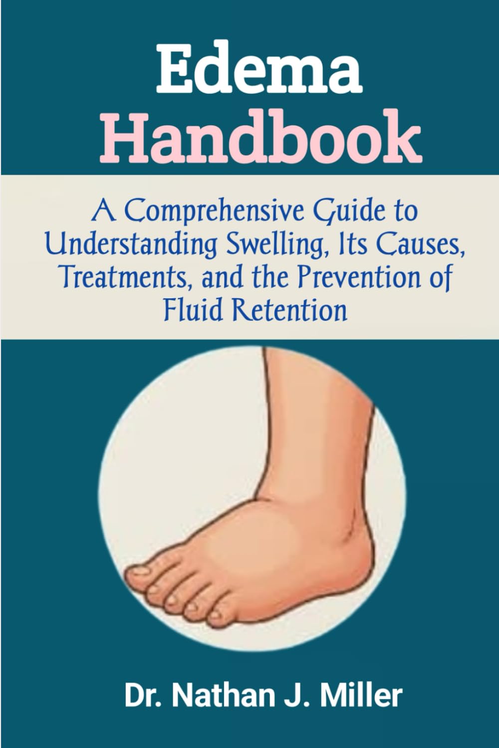 Edema Handbook: A Comprehensive Guide to Understanding Swelling, Its Causes, Treatments, and the Prevention of Fluid Retention