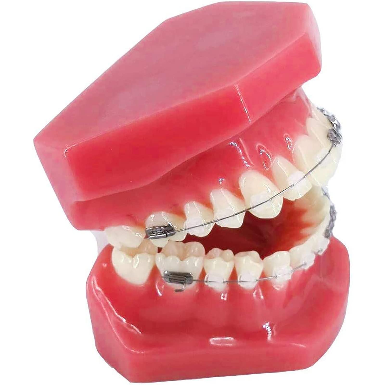 Model ortodontyczny zębów z metalowymi i ceramicznymi zamkami Modele demonstracyjne dla stomatologa do komunikacji z pacjentami.