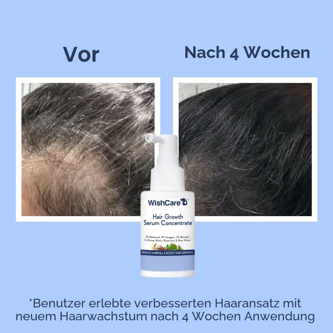 WishCare Haarwachstumsserum mit Rosmarin, Redensyl, Anagain, Baicapil, Koffein, Biotin