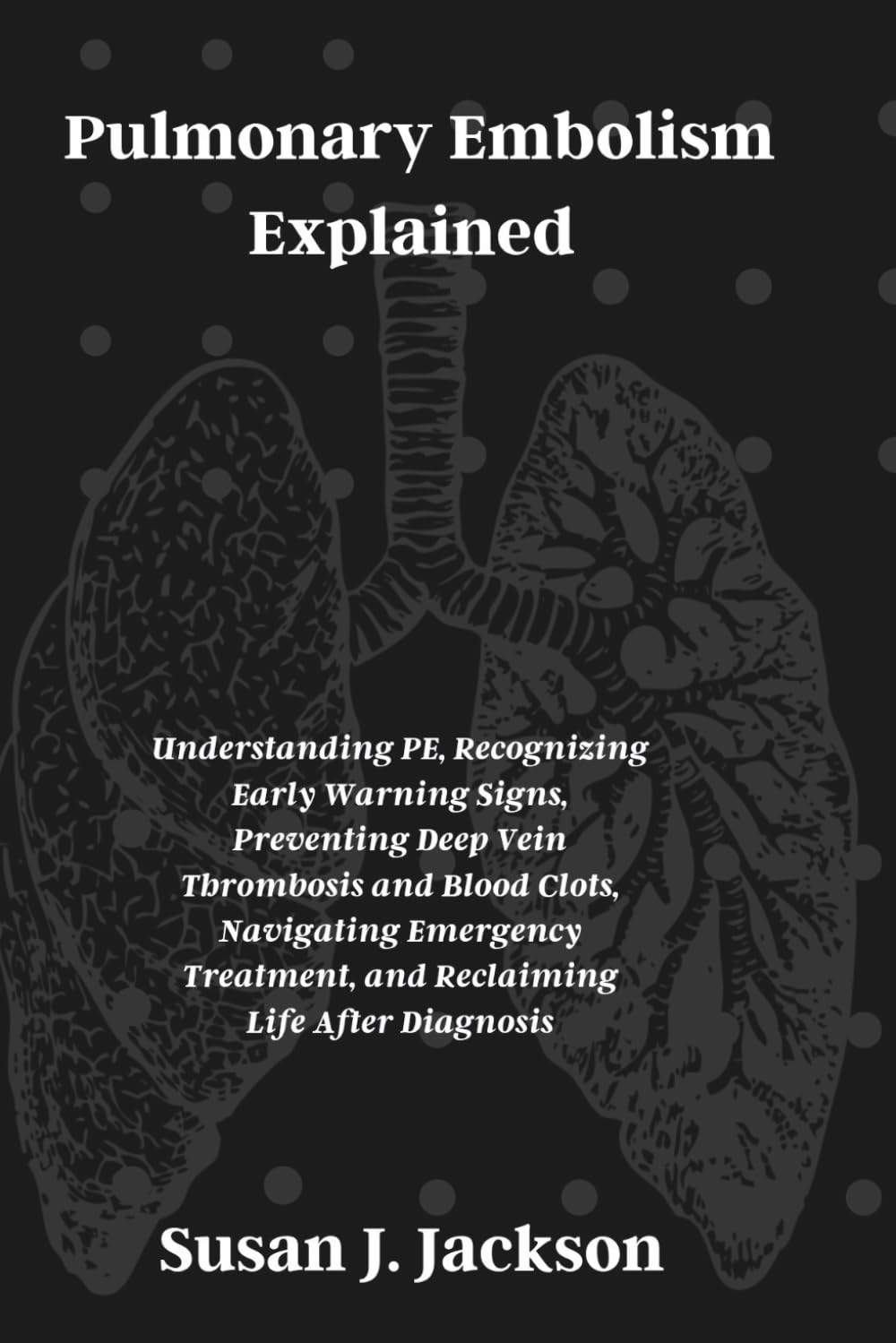 Pulmonary Embolism Explained: Understanding PE, Recognizing Early Warning Signs, Preventing Deep Vein Thrombosis and Blood Clots, Navigating Emergency Treatment, and Reclaiming Life After Diagnosis