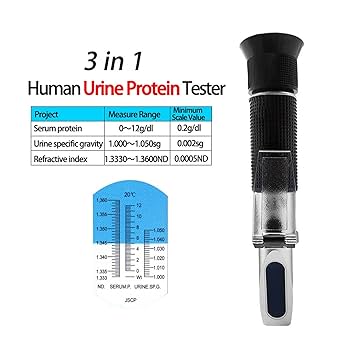 ポケット尿比重計 Amazon | 【アタゴ公式】ポケット 尿比重屈折計 ペット用品 自宅