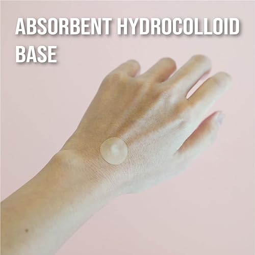 Miniatura 8 de quitch Alternativa para aliviar la picazón de insectos  Alternativa para aliviar la picazón de mosquitos naturales para niños  Esencial para viajes