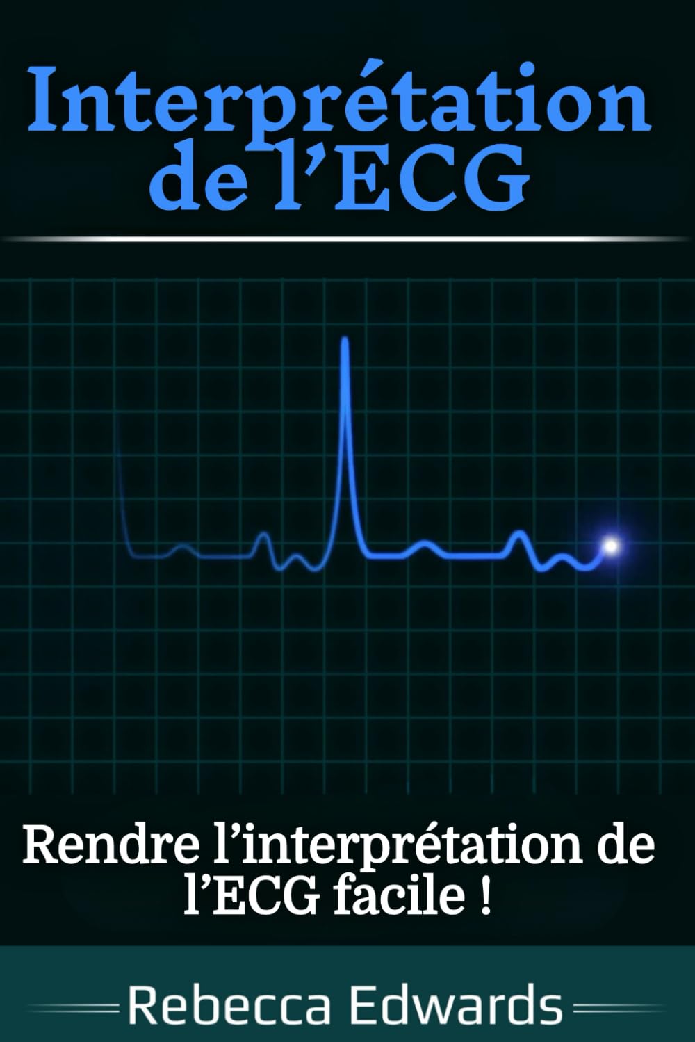 Interprétation de l’ECG: Rendre l’interprétation de l’ECG facile !