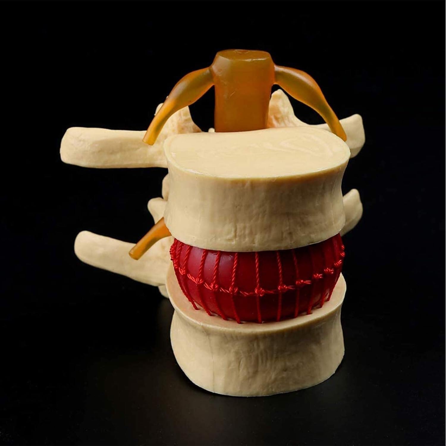 Model anatomiczny człowieka, anatomia jamy ustnej, ludzki przepuklina dysku lędźwiowego, model demonstracyjny, anatomia ludzkiego kręgosłupa, ludzki kręgosłup, kręgosłup lędźwiowy