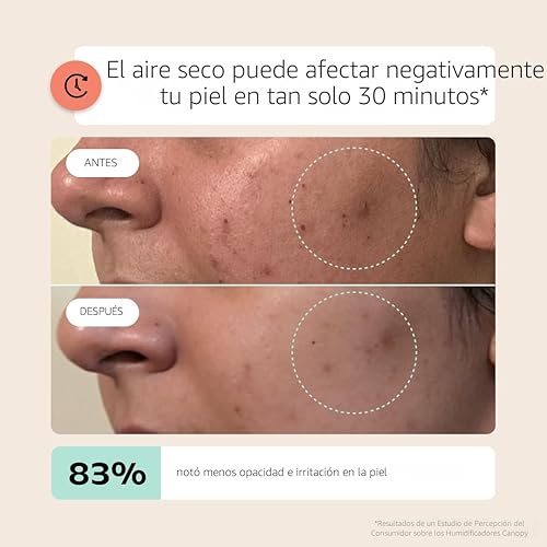 Miniatura 7 de Canopy Humidificador de cabecera 2.0, blanco, tiempo de funcionamiento de 36 horas, capacidad de 2.5 litros, luz de lectura y ruido blanco, alivia