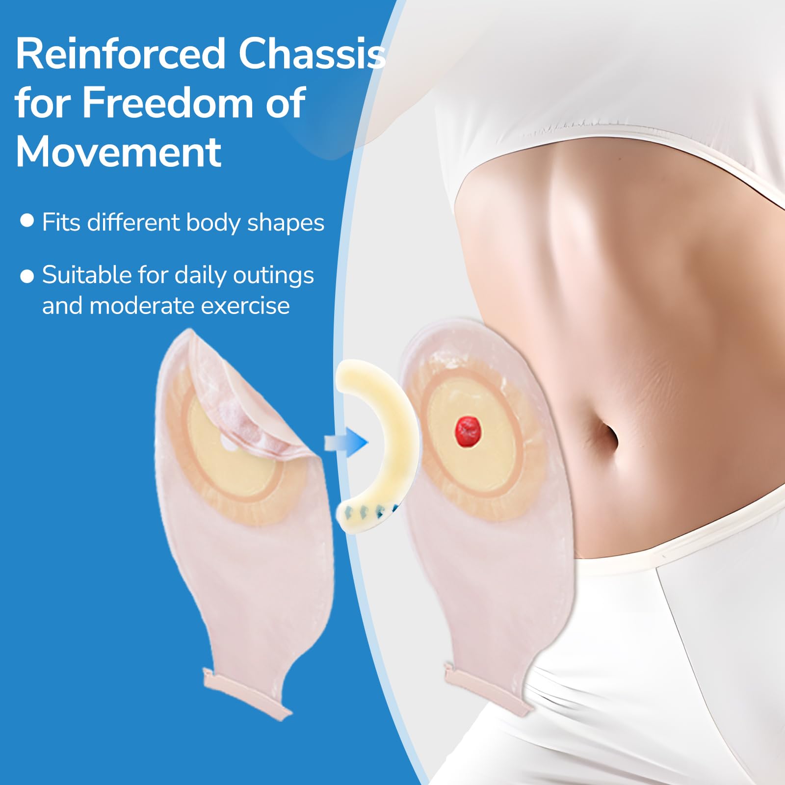 20 Tiras EláSticas de Barrera para Ostomía, Tiras de Barrera CutáNea Hidrocoloide de Grado MéDico, Cinta Adhesiva Impermeable y Respetuosa Con La Piel para Bolsas de Estoma de Colostomía