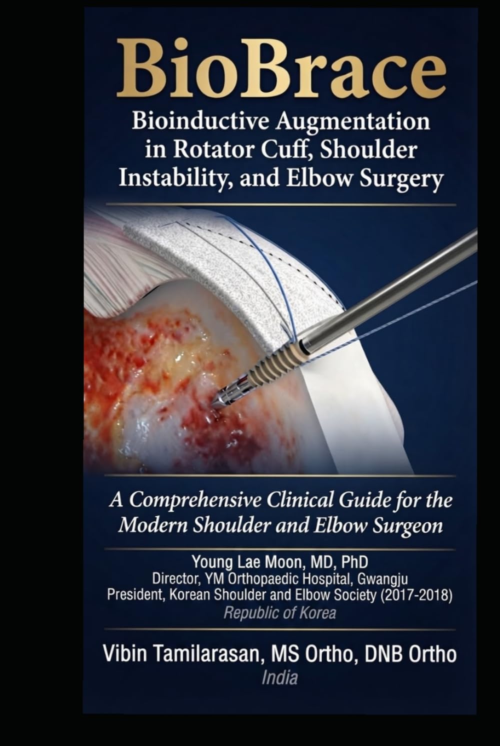 BioBrace : Bioinductive Augmentation in Rotator Cuff, Shoulder Instability, and Elbow Surgery: A Comprehensive Clinical Guide for the Modern Shoulder and Elbow Surgeon