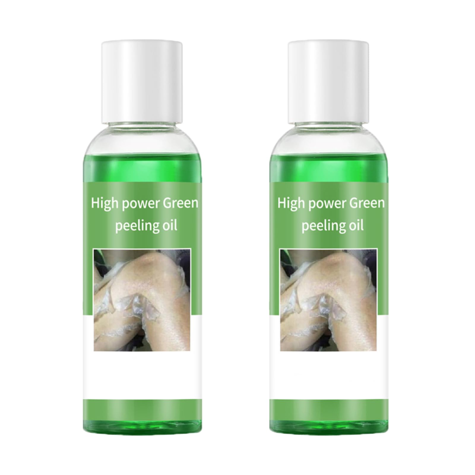 Dark Skin Exfoliating Oil, Extra Strong Green for Hands, Feet and Whole Body for at-home facial chemical exfoliation (220 ml/7.76 oz)