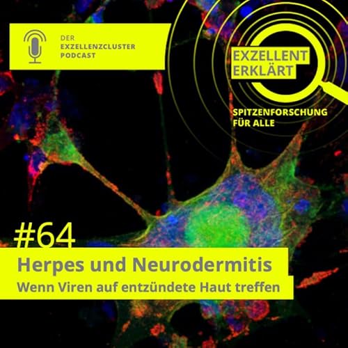 Herpes und Neurodermitis &ndash; Wenn Viren auf entz&uuml;ndete Haut treffen
