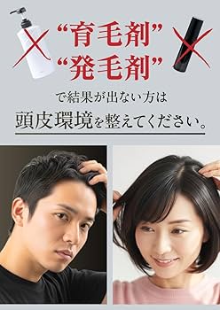 エクソナイン　頭皮用セラム　正規品 スカルプセラム（頭皮用）80g | ビューコスメティック-頭皮を