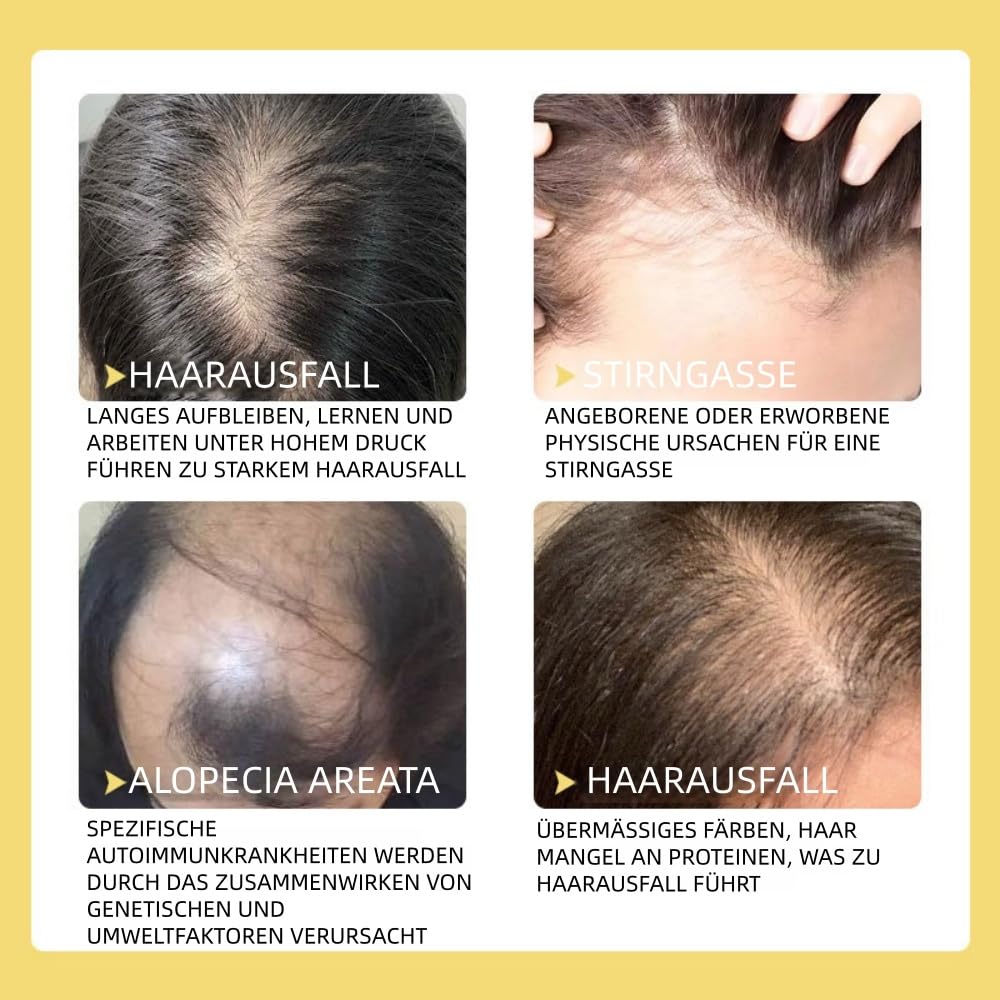 Teluni Carvenchy 60ml Natürliches Haaröl mit Rosmarin - Haarwachstum, Dichteres Haar & Mehr Volumen für Frauen und Männer