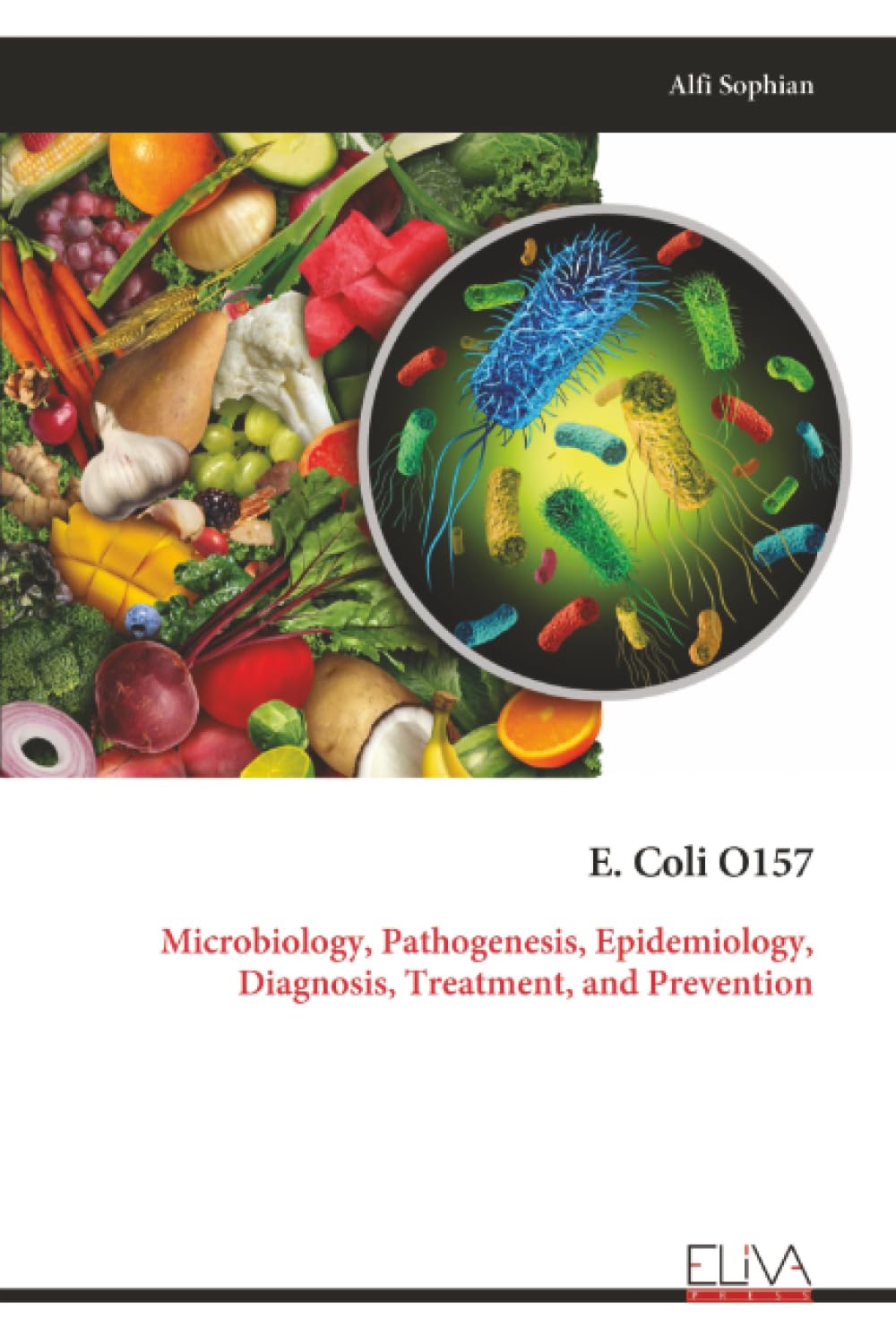 E. Coli O157: Microbiology, Pathogenesis, Epidemiology, Diagnosis, Treatment, and Prevention