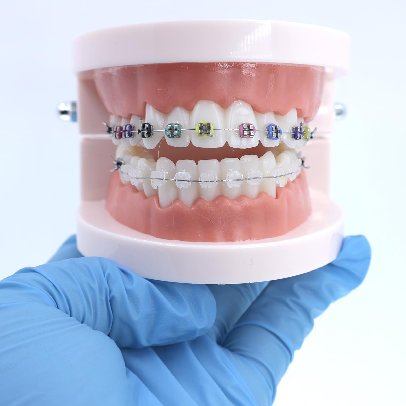 Fuioda Dental Teaching Model Standard Dental Orthodontic Teeth Model with Braces Half Metal/Half Ceramic Orthodontic Brackets for Dentistry Education Study