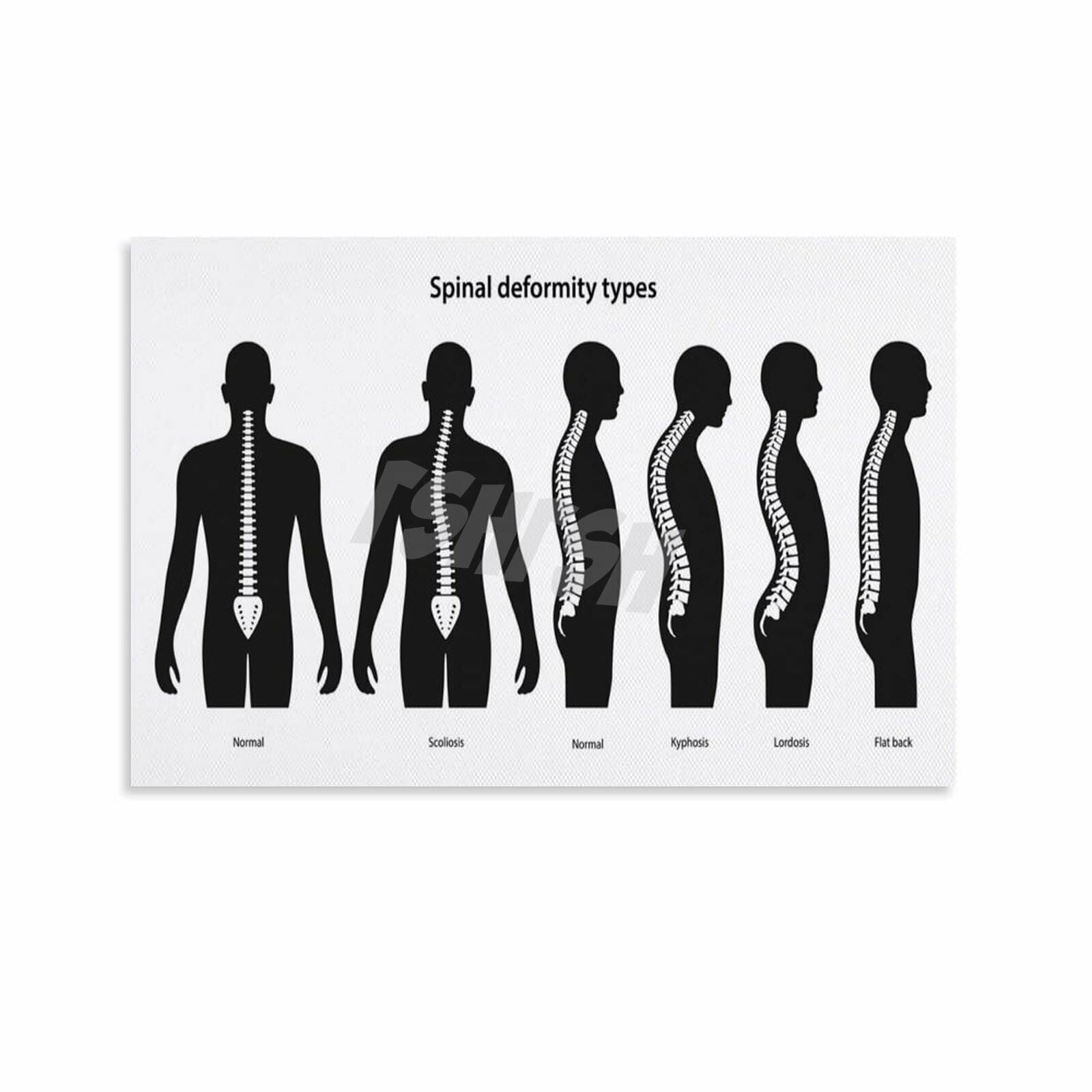 EKFBQBGW Chiropractic Office Decor Spine Chart Canvas Wall-Art for Physical Room Therapist Gift Unframed,08x12inch(20x30cm)