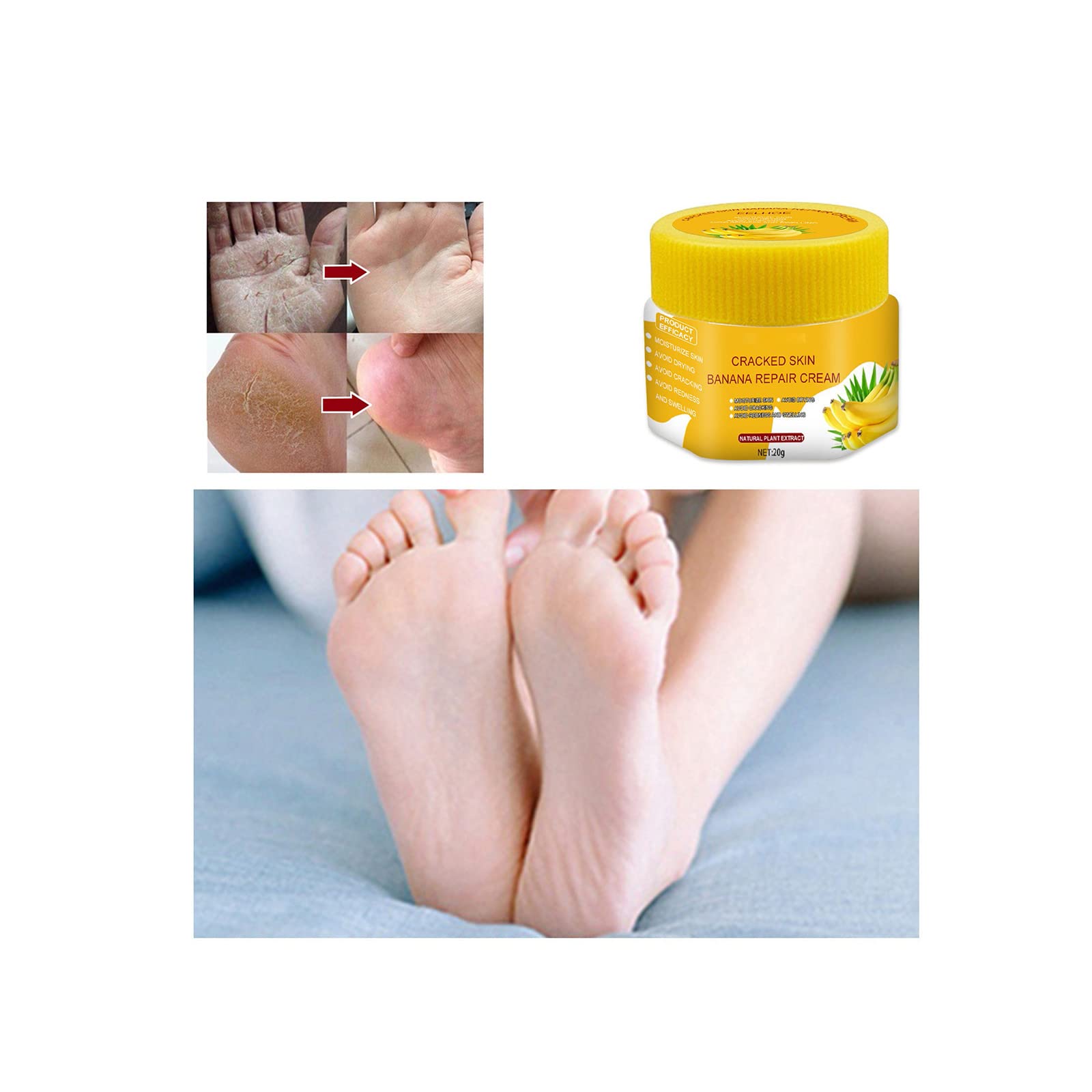 Banana Repairs Cream Foot Cream for Extremely Dry, Cracked Hands Foot, Intensive Foot Repair Skin Cream For Foot Care, Athletes Foot Treatment, Dry Skin