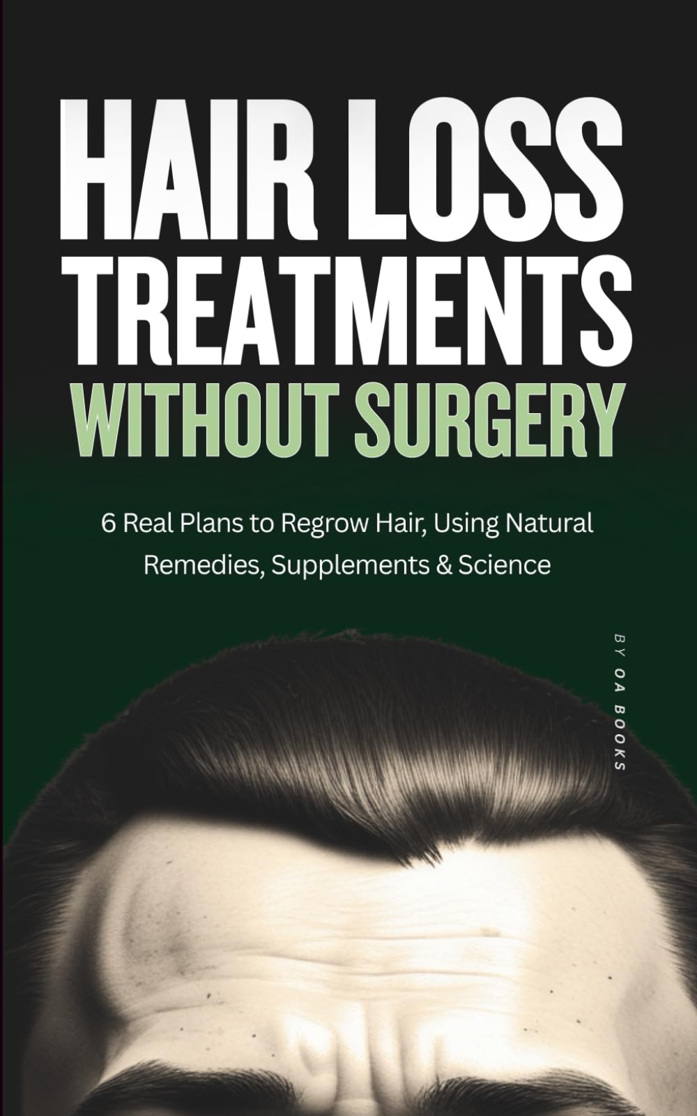 Hair Loss Treatment Without Surgery: 6 Real Plans to Regrow Hair Using Natural Remedies, Supplements & Science (How To Stop Hair Loss)