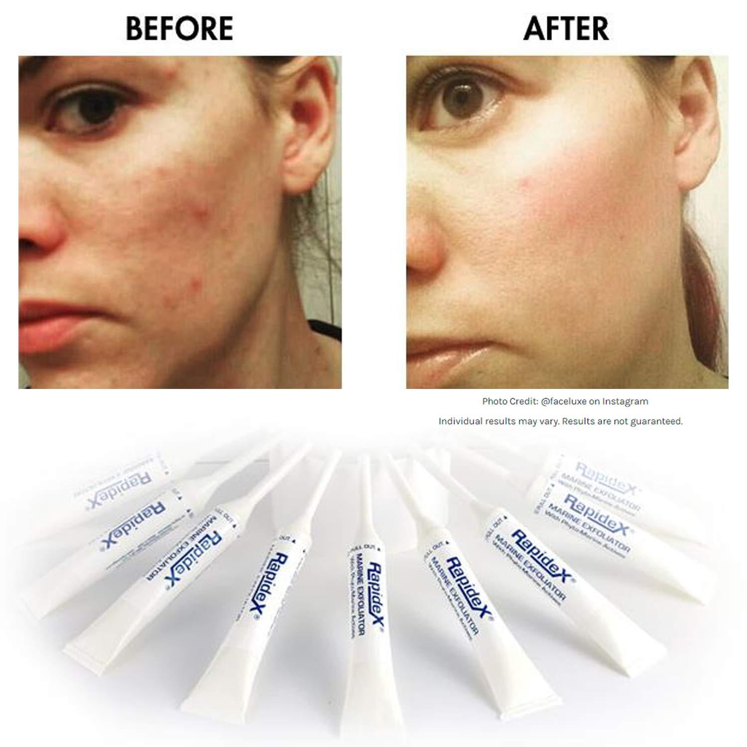 Repechage suave exfoliante cara para anti envejecimiento exfoliante facial natural con glicólico y alfa hidroxiácidos de limpieza profunda de los poros y abrillantadores piel Rapidex 14 recuento