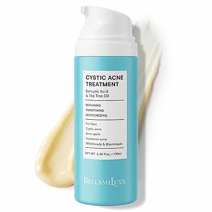 Cystic Acne Treatment for Face: Hormonal Acne Treatment Cream for Teens & Adults - Salicylic Acid & Tea Tree Oil Pimple Spot Remover - Anti-Acne Moisturizer Reduces Redness, Blemishes