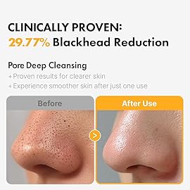 Hanskin Pore Cleansing Oil, Oil Cleanser for Face, Makeup Blackhead Sebum Remover, Korean Deep Pore Cleanser for Sensitive Skin [PHA] (10.14 oz)