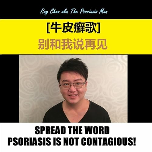 牛皮癣歌 别和我说再见 Chinese Psoriasis Song By Ray Chua On Amazon Music Amazon Com