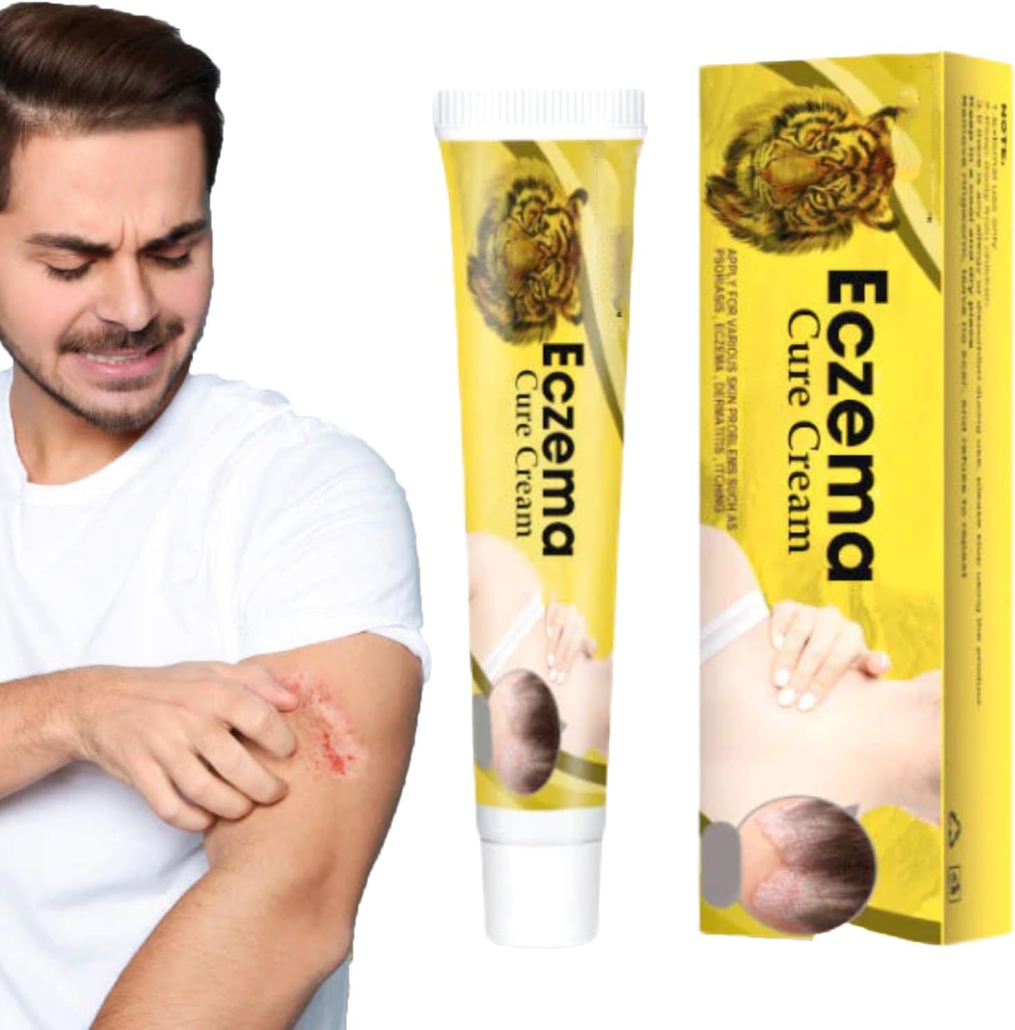 2023 NEWewRevitaskin Eczema Cure Cream, 20g Eczema Psoriasis Cream, Eczema Relief Flare-Up Treatment, Eczema Treatment for Adults, Suitable for All Skins (1 Pcs)