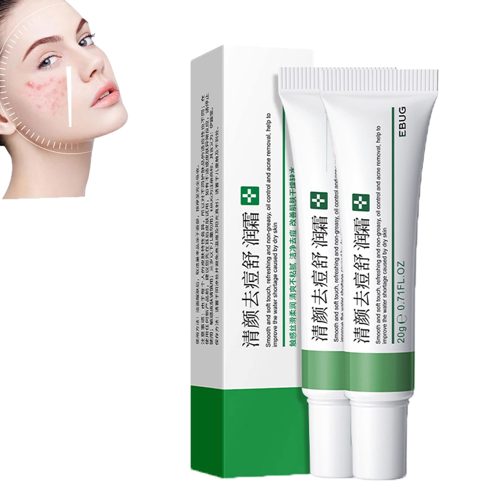 Whitening Freckle Cream,Acne Scar Removal Treatment Cream,Pigmentation Removal Cream For Face,Remove Melasma Acne Cream Fading Spot Cream,Dark Spot Corrector For Face (3PCS,Acne Relief)