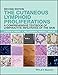 The Cutaneous Lymphoid Proliferations: A Comprehensive Textbook of Lymphocytic Infiltrates of the Skin