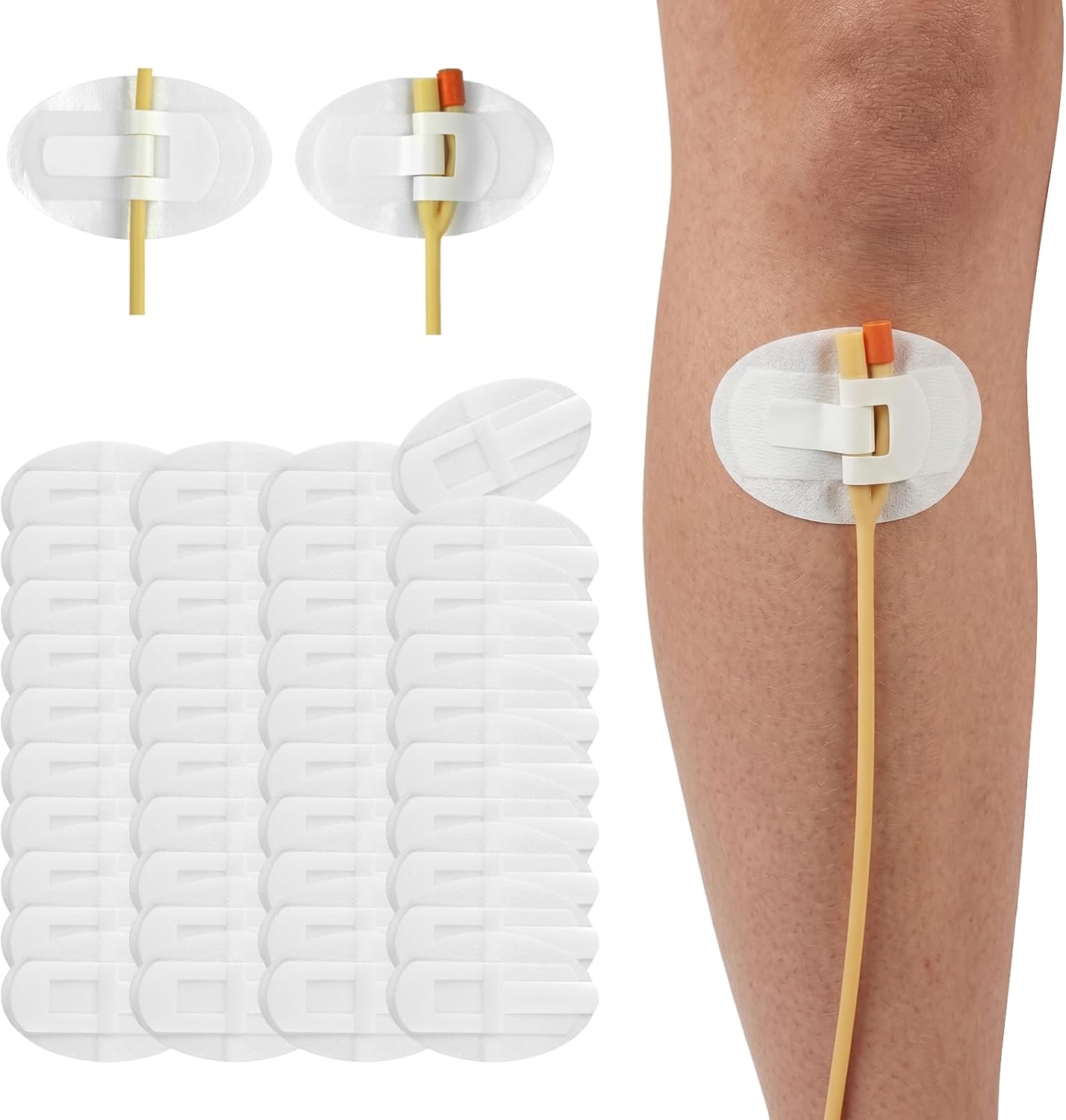 Catheter Stabilization Device, Catheter Securement Device with Extra-Large Self-Adhesive Hook, Breathable Catheter Stabilization Device for NG/J/G Feeding Tubes (40Pcs)