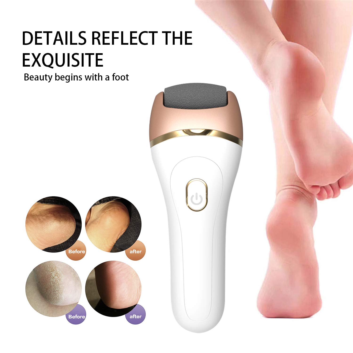 Broyeur de pieds électrique USB Broyeur de pieds rechargeable Artefact Peeling Peaux mortes callosités Pédicure Talon Lisse Artefact Voyage Pédicure