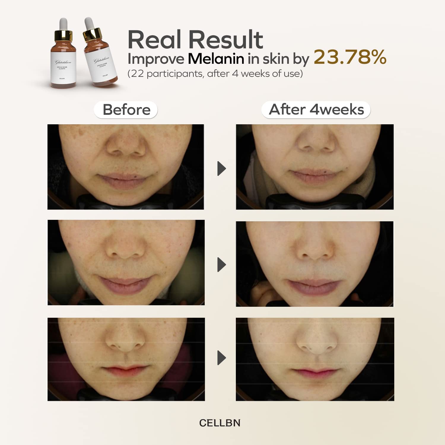 CELLBN Glutathione Ampoule Serum for Dark Spot Corrector | Whitening &  Anti-Wrinkle | Wrinkle Repair, Anti-Aging, Melanin Care, Decreasing  Blemish, Pigmentation Korean Skincare 30ml / 1.01 fl.oz : Amazon.sg: Beauty